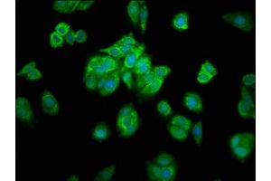 Immunofluorescence staining of HepG2 cells with ABIN7142357 at 1:200, counter-stained with DAPI. (MRPL16 antibody  (AA 37-251))