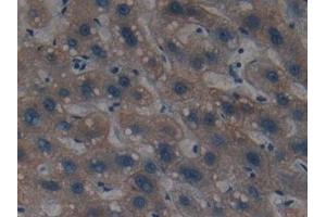 Detection of CK4 in Human Liver Tissue using Polyclonal Antibody to Cytokeratin 4 (CK4) (KRT4 antibody  (AA 152-457))