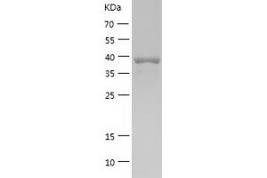 BCL6 Protein (AA 1-174) (His-IF2DI Tag)