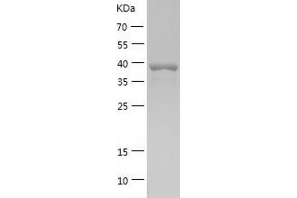 BCL6 Protein (AA 1-174) (His-IF2DI Tag)