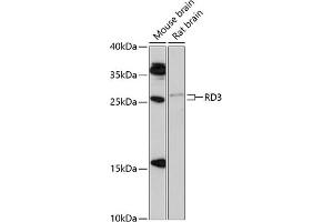 Western blot analysis of extracts of various cell lines, using RD3 antibody (ABIN6133326, ABIN6146834, ABIN6146835 and ABIN6217059) at 1:1000 dilution. (RD3 antibody  (AA 1-195))