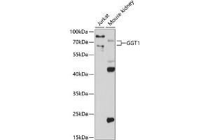 Western blot analysis of extracts of various cell lines, using GGT1 antibody (ABIN3022526, ABIN3022527, ABIN3022528 and ABIN6218881) at 1:1000 dilution. (GGT1 antibody  (AA 370-569))
