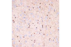 Immunohistochemistry of paraffin-embedded mouse brain using Gelsolin Rabbit mAb (ABIN7267364) at dilution of 1:100 (40x lens). (Gelsolin antibody)