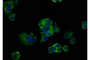 Immunofluorescence staining of MCF-7 cells with ABIN7153155 at 1:133, counter-stained with DAPI. (FREM2 antibody  (AA 1986-2127))