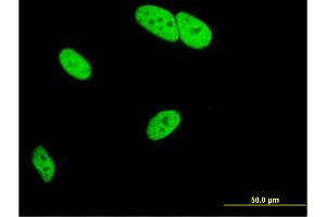 Immunofluorescence of monoclonal antibody to MED9 on HeLa cell. (MED9 antibody  (AA 1-146))