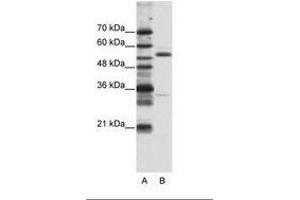 Image no. 1 for anti-Zinc Finger Protein 655 (ZNF655) (N-Term) antibody (ABIN203180)