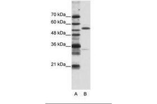 ZNF655 Antikörper  (N-Term)