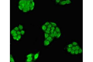 Immunofluorescent analysis of PC-3 cells using ABIN7159078 at dilution of 1:100 and Alexa Fluor 488-congugated AffiniPure Goat Anti-Rabbit IgG(H+L) (MXI1 antibody  (AA 75-173))