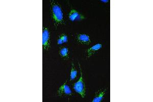 IF analysis of ACAA2 using anti-ACAA2 antibody (ABIN4886414).