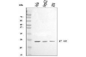 Western blot analysis of ND6/MT-ND6 using anti-ND6/MT-ND6 antibody (ABIN7599589).