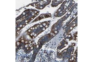 Immunohistochemical staining of human colon with WSCD2 polyclonal antibody  shows strong cytoplasmic positivity, with a granular pattern, in glandular cells. (WSCD2 antibody)