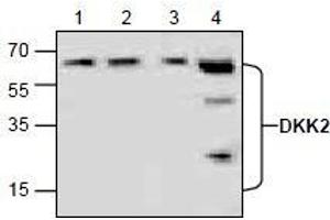 AP26356PU-N: Western blot analysis of Dkk2 in lysate from Jurkat cells (Lane 1,2), 3T3 cells (Lane 3) and rat kidney (Lane 4). (DKK2 antibody)