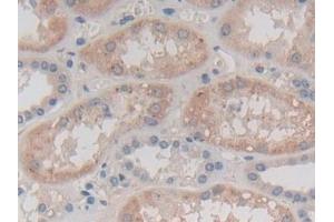 Detection of CAPN3 in Human Kidney Tissue using Polyclonal Antibody to Calpain 3 (CAPN3) (Calpain 3 antibody  (AA 602-821))