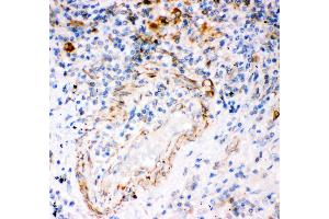 Immunohistochemistry (IHC) image for anti-Inositol 1,4,5-Trisphosphate Receptor, Type 1 (ITPR1) (AA 2411-2758) antibody (ABIN3043862)