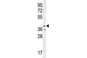 Caspase-12 antibody western blot analysis in HL-60 lysate (Caspase 12 antibody  (AA 165-193))