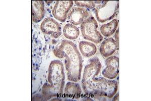 S Antibody (Center) (ABIN656799 and ABIN2846017) immunohistochemistry analysis in formalin fixed and paraffin embedded human kidney tissue followed by peroxidase conjugation of the secondary antibody and DAB staining. (SP140 antibody  (AA 272-301))