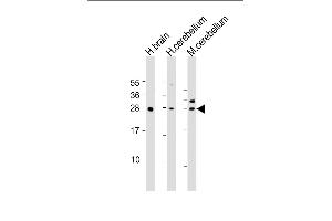 All lanes : Anti-KCTD11 Antibody (N-Term) at 1:1000-1:2000 dilution Lane 1: human brain lysate Lane 2: human cerebellum lysate Lane 3: mouse cerebellum lysate Lysates/proteins at 20 μg per lane. (KCTD11 antibody  (AA 21-53))