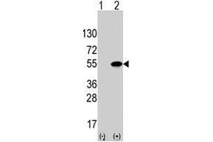 Western blot analysis of ATF4 (arrow) using rabbit ATF4 polyclonal antibody . (ATF4 antibody  (Ser245))