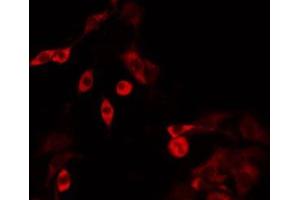 ABIN6275182 staining HT29 by IF/ICC. (GBP3 antibody  (C-Term))