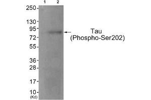 Western blot analysis of extracts from JK cells (Lane 2), using Tau (Phospho-Ser202) Antibody. (MAPT antibody  (pSer202))