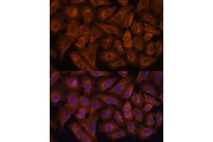 Immunofluorescence analysis of U-2 OS cells using NEXN antibody (ABIN6132932, ABIN6144546, ABIN6144547 and ABIN6217017) at dilution of 1:100. (NEXN antibody  (AA 516-675))