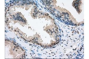 Immunohistochemical staining of paraffin-embedded pancreas tissue using anti-ERCC1 mouse monoclonal antibody. (ERCC1 antibody)