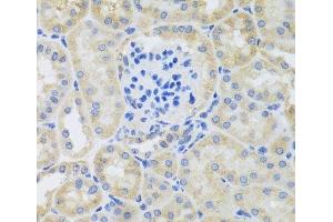 Immunohistochemistry of paraffin-embedded Mouse kidney using BNIP3 Polyclonal Antibody at dilution of 1:100 (40x lens). (BNIP3 antibody)