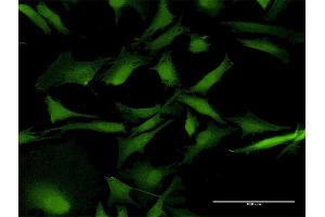 Immunofluorescence of purified MaxPab antibody to RAB31 on HeLa cell. (RAB31 antibody  (AA 1-195))