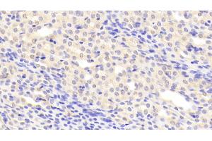 Detection of C1INH in Mouse Kidney Tissue using Polyclonal Antibody to Complement 1 Inhibitor (C1INH) (SERPING1 antibody  (AA 35-179))