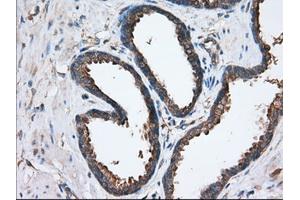 Immunohistochemical staining of paraffin-embedded Human liver tissue using anti-SNX9 mouse monoclonal antibody. (SNX9 antibody)