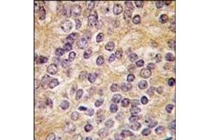 Image no. 2 for anti-Plasminogen Activator, Urokinase (PLAU) (C-Term) antibody (ABIN360681) (PLAU antibody  (C-Term))