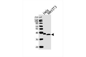 Lane 1: Hela Cell lysates, Lane 2: NIH/3T3 Cell lysates, probed with NFKBIA (1121CT8. (NFKBIA antibody)