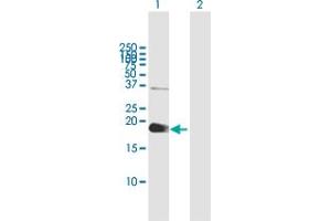 Western Blot analysis of ZCCHC13 expression in transfected 293T cell line by ZCCHC13 MaxPab polyclonal antibody. (ZCCHC13 antibody  (AA 1-166))