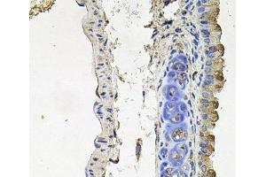 Immunohistochemistry of paraffin-embedded Mouse lung using NDUFA6 Polyclonal Antibody at dilution of 1:100 (40x lens). (NDUFA6 antibody)