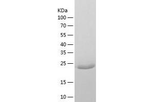 FVT1 Protein (AA 26-270) (His tag)