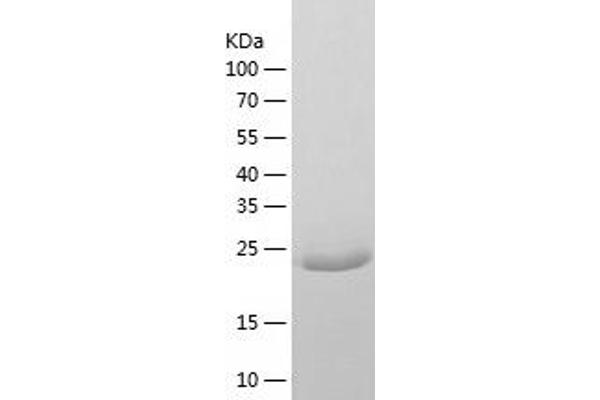 FVT1 Protein (AA 26-270) (His tag)