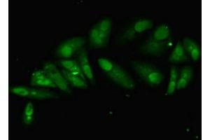 Immunofluorescent analysis of Hela cells using ABIN7155120 at dilution of 1:100 and Alexa Fluor 488-congugated AffiniPure Goat Anti-Rabbit IgG(H+L) (HNRNPL antibody  (AA 89-335))