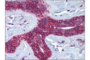 Human Breast: Formalin-Fixed, Paraffin-Embedded (FFPE) (Cathepsin L2 antibody  (Internal Region))