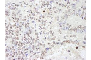 Immunohistochemistry (IHC) image for anti-RNA Binding Motif Protein 25 (RBM25) (AA 475-525) antibody (ABIN7448762) (RBM25 antibody  (AA 475-525))