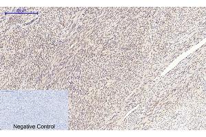 Immunohistochemical analysis of paraffin-embedded human uterus tissue. (c-MYC antibody  (AA 360-440))