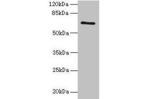 Western blot All lanes: HEATR9 antibody at 1. (C17orf66 antibody  (AA 1-219))