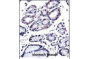 Immunohistochemistry (Paraffin-embedded Sections) (IHC (p)) image for anti-GTPase Activating Protein (SH3 Domain) Binding Protein 1 (G3BP1) (AA 401-430), (C-Term) antibody (ABIN657707)