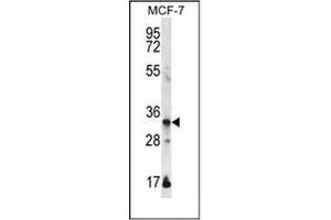 Western blot analysis of EVPLL Antibody (Center) in MCF-7 cell line lysates (35ug/lane). (Envoplakin-Like antibody  (Middle Region))