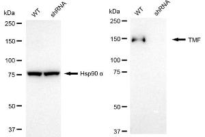 anti-TATA Element Modulatory Factor 1 (TMF1) antibody