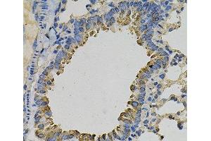 Immunohistochemistry of paraffin-embedded Mouse lung using PSAT1 Polyclonal Antibody at dilution of 1:100 (40x lens). (PSAT1 antibody)