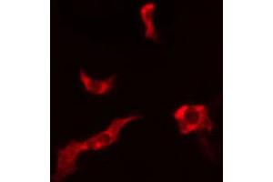 ABIN6266975 staining LOVO cells by IF/ICC. (ATPBD3 antibody  (C-Term))