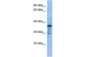 Host:  Rabbit  Target Name:  C1galt1c1  Sample Type:  Rat pancreas lysates  Antibody Dilution:  1. (C1GALT1C1 antibody  (N-Term))
