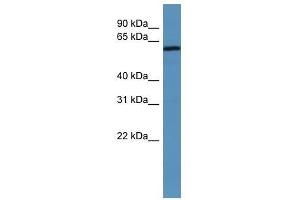 MAGED2 antibody used at 0. (MAGED2 antibody  (N-Term))