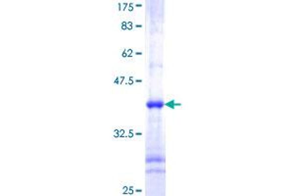 IKK alpha Protein (AA 646-745) (GST tag)