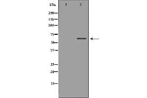 Western blot analysis of extracts of mouse kidney, using PAK1 antibody.